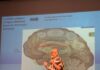 II Jornadas de Neurorreabilitação do Algarve juntam conhecimento e inovação em São Brás de Alportel